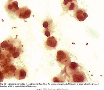 Neisseria gonorrhoeae diplococci in exudate