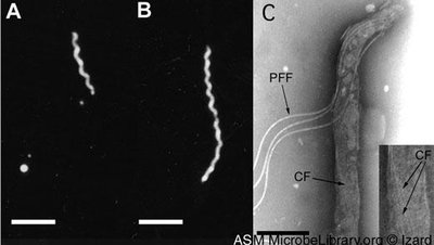 Treponema spirochetes under microscopy