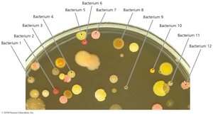 Bacterial colonies on a solid surface (agar)