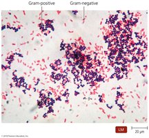 Results of Gram staining: Gram-positive and Gram-negative bacteria