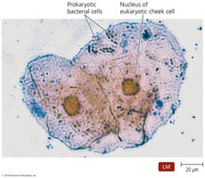 Cells of the bacterium Streptococcus and human cheek cells