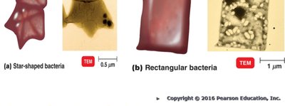 Unusual shapes of bacteria
