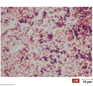 Gram stain of mixed bacteria
