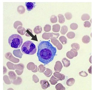 Primary and secondary antibody immune responses