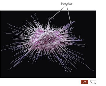Dendritic cell with dendrites