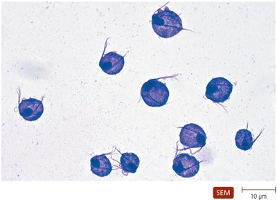 Trichomonas vaginalis