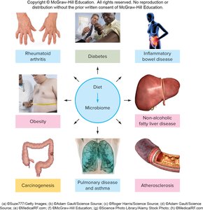 Diseases associated with microbiome dysbiosis