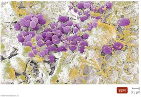 SEM of dental plaque biofilm