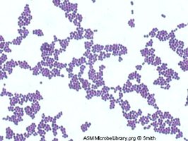 Staphylococcus aureus under microscope
