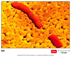 Bacterial cell under microscope
