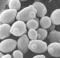 Yeast cells under microscope