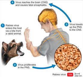 Diagram of rabies virus pathogenesis in humans