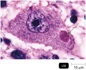 Negri body in neuron (histological image)