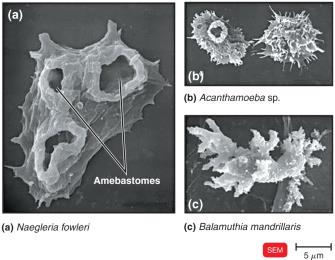 SEM images of amoebae causing meningoencephalitis