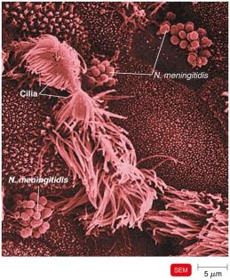 SEM of Neisseria meningitidis interacting with cilia