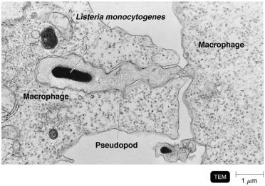 TEM of Listeria monocytogenes spreading between macrophages