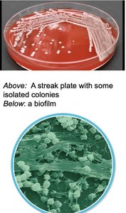 Streak plate with isolated colonies and a biofilm