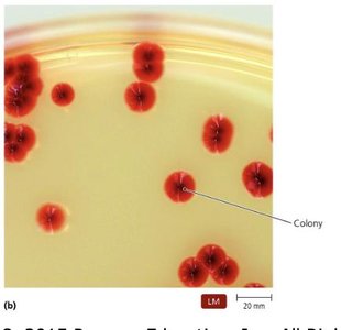 Bacterial colony on agar plate