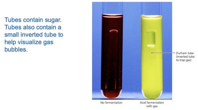 MacConkey agar results
