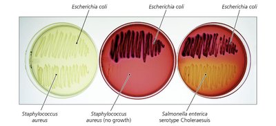 Anaerobic culture system
