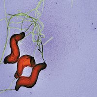 Campylobacter jejuni