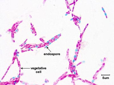 Endospore stain showing endospores and vegetative cells