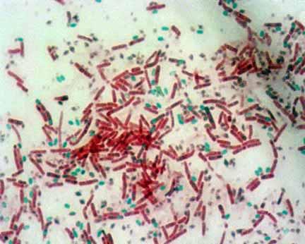 Microscopic image showing endospore staining with green spores and red vegetative cells