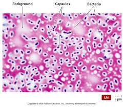 Microscopic image showing capsule staining with clear halos around bacterial cells