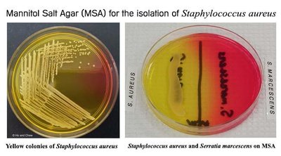 MSA plate showing yellow and red colonies for Staphylococcus species