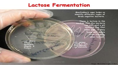 MacConkey agar showing lactose fermentation results