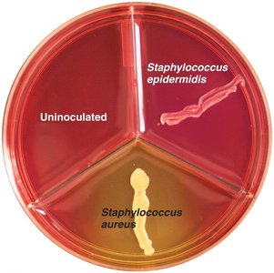 Mannitol salt agar plate showing selective and differential properties