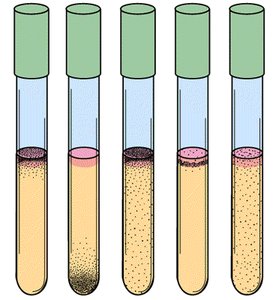 Test tubes showing growth patterns of bacteria with different oxygen requirements