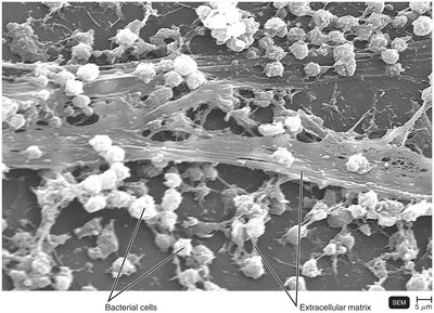 SEM image of bacterial biofilm with extracellular matrix