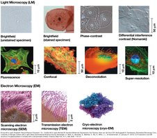 Types of microscopy and example images