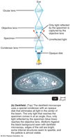 Dark-field microscopy diagram and example