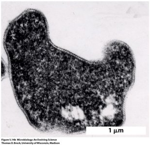 Acidophilic microorganism under the microscope