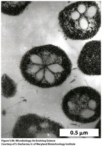 Halophilic microorganisms under the microscope