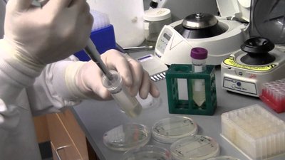 Petri dishes with various types of culture media