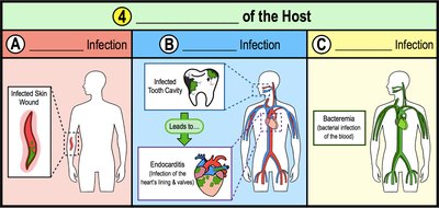 Types of infection: local, focal, systemic