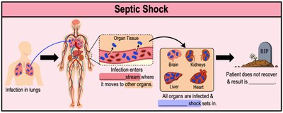 Septic shock progression