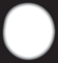 Eukarya LM Amoeba proteus