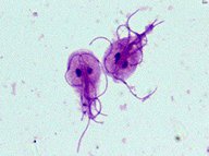 Leishmania protozoa