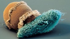 Entamoeba protozoa