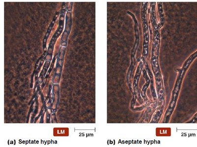 Septate and aseptate hyphae