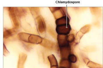 Chlamydospore