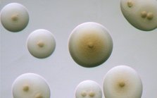 Mycoplasma colonies