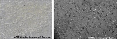 Cytopathic effect in bovine spleen cells: normal (left) and infected (right)