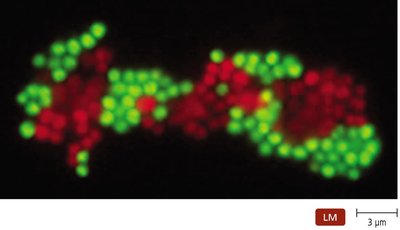 Fluorescent in Situ Hybridization (FISH)