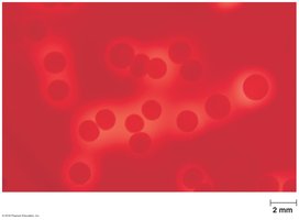 Blood agar as a differential medium