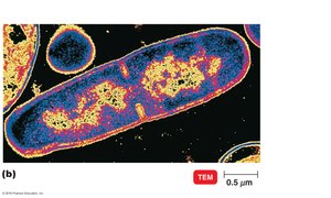 Bacillus licheniformis dividing